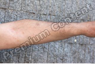 Forearm texture of street references 401 0001